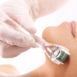 Why Microneedling Is A Trend Now