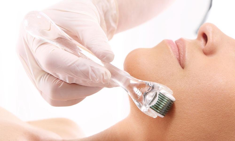 Why Microneedling Is A Trend Now