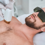 Trends in Laser Hair Removal Services
